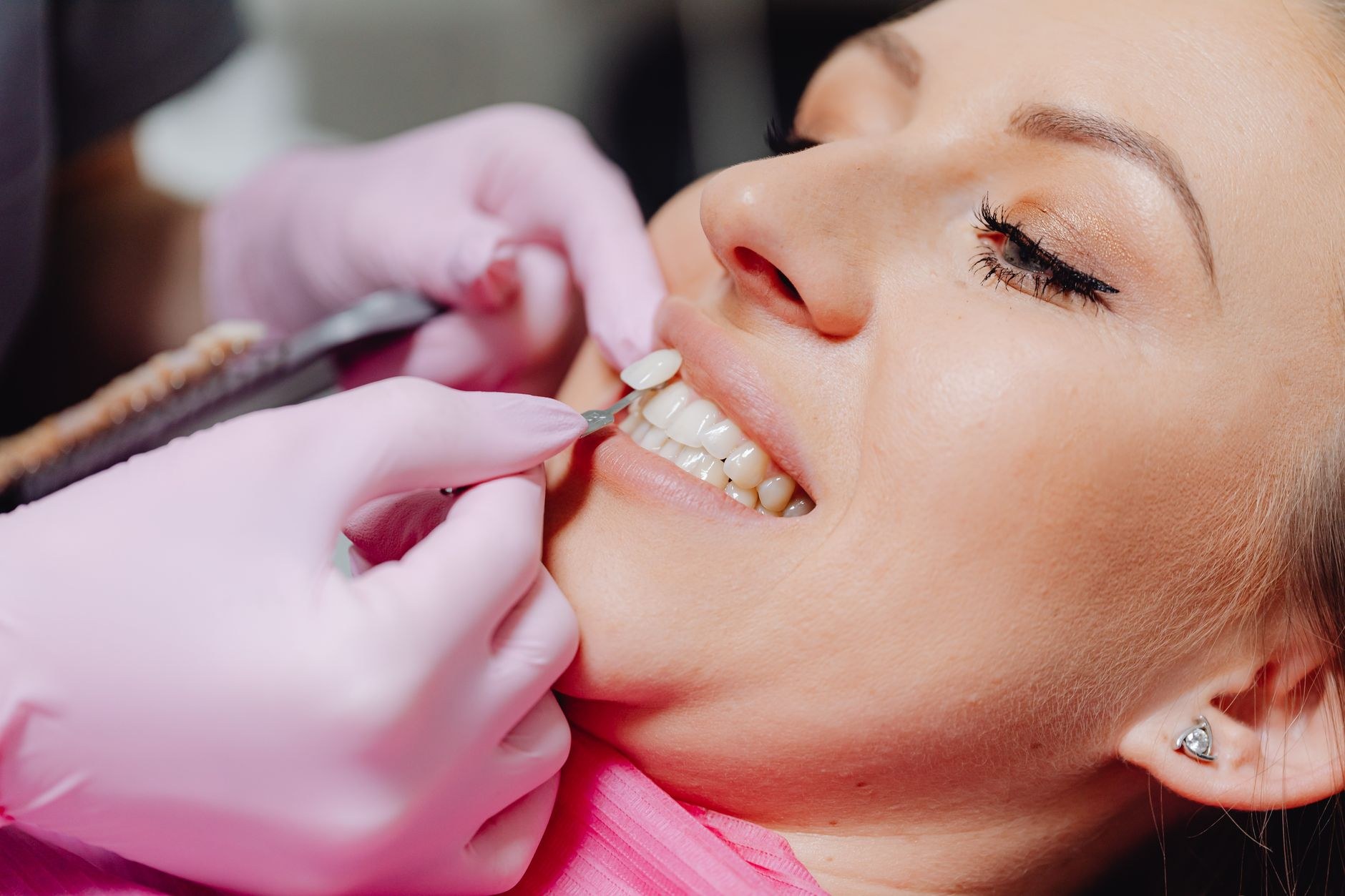 Hand-placed tooth gem being applied up close (sample image)