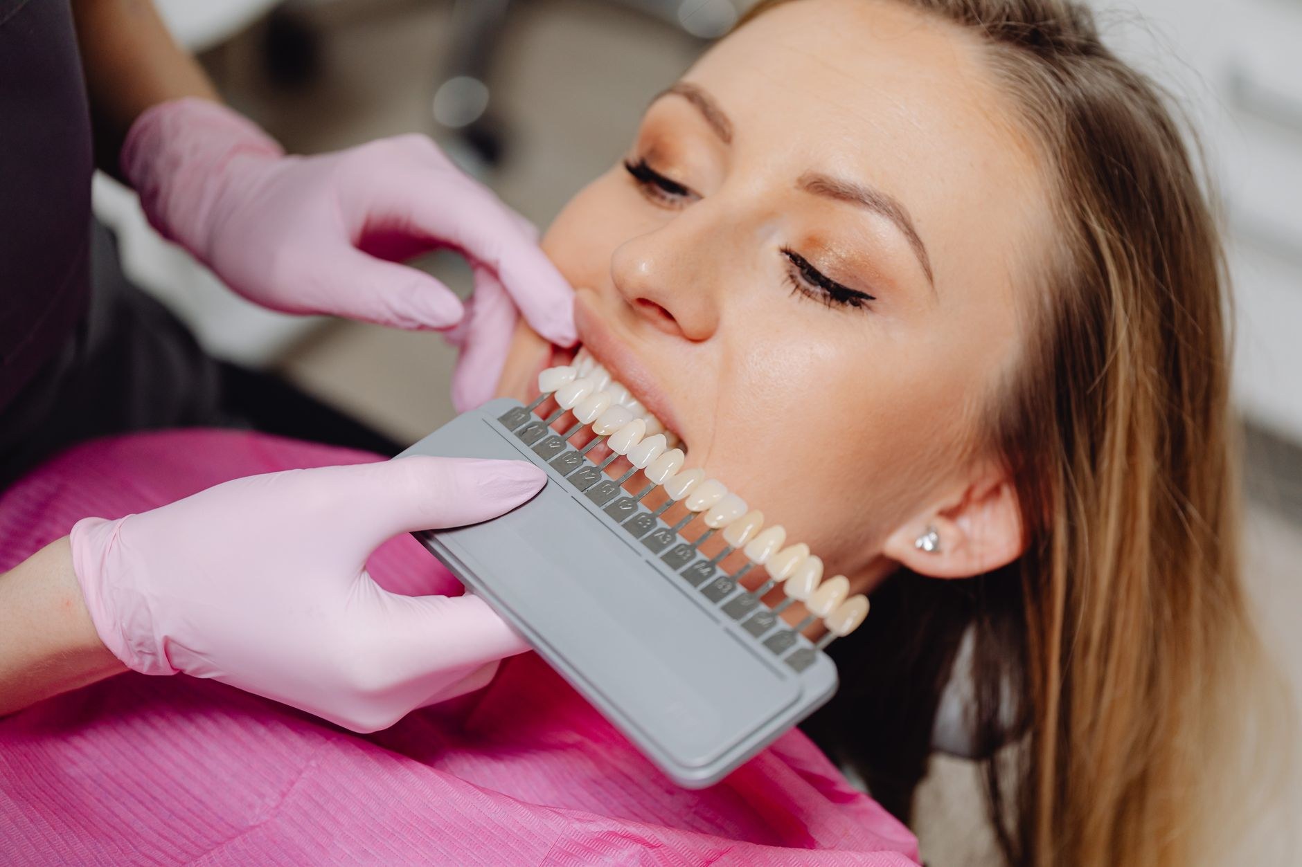 Professional teeth whitening treatment in progress (sample image)